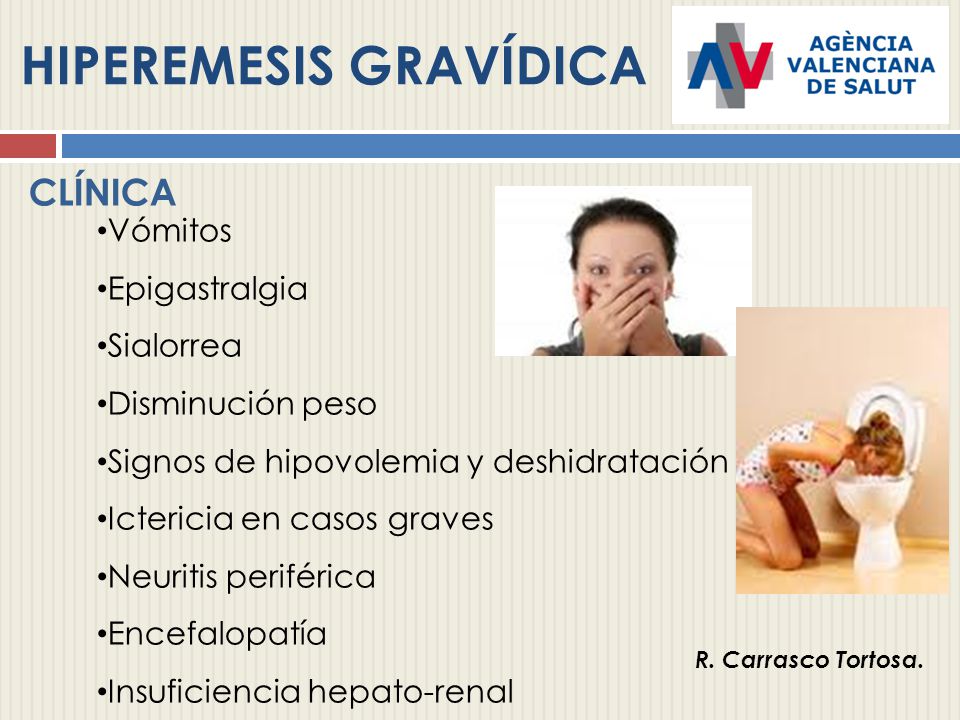 hiperemesis gravidica signos y sintomas de diabetes hiperemesis gravidica signos y sintomas de diabetes